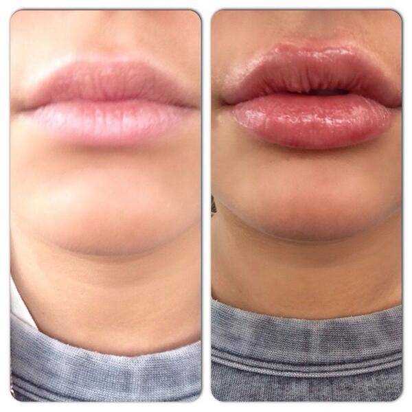 Внешние изменения