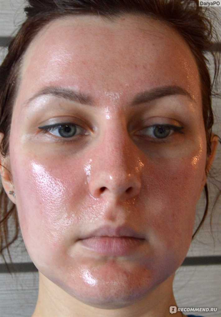 Что делать, если после пилинга шелушится кожа? Что делать, если после пилинга шелушится кожа?