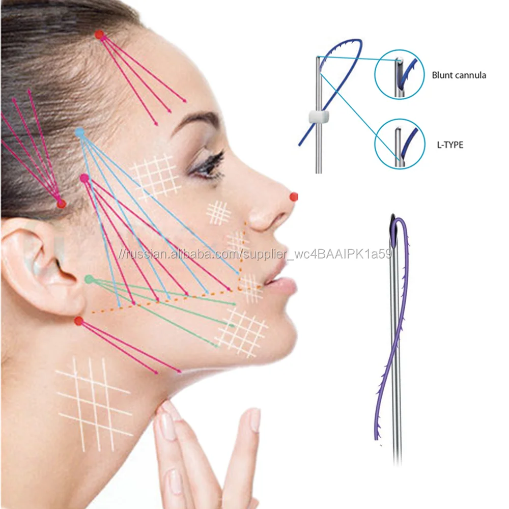 Преимущества использования нитей Cog