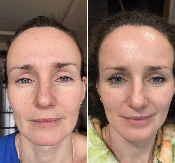 Рекомендации врача