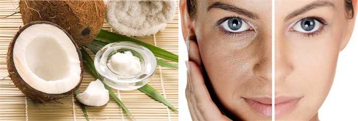 Преимущества кокосового масла для лица