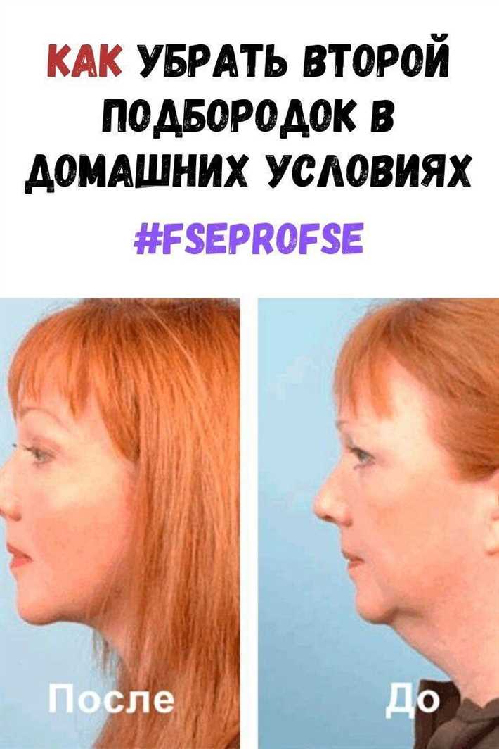 3. Потеря упругости кожи