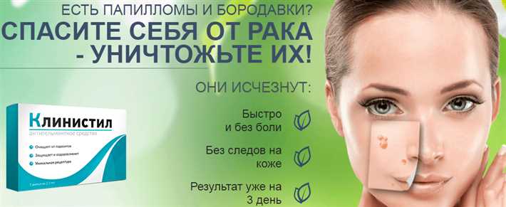 1. Экономия денег