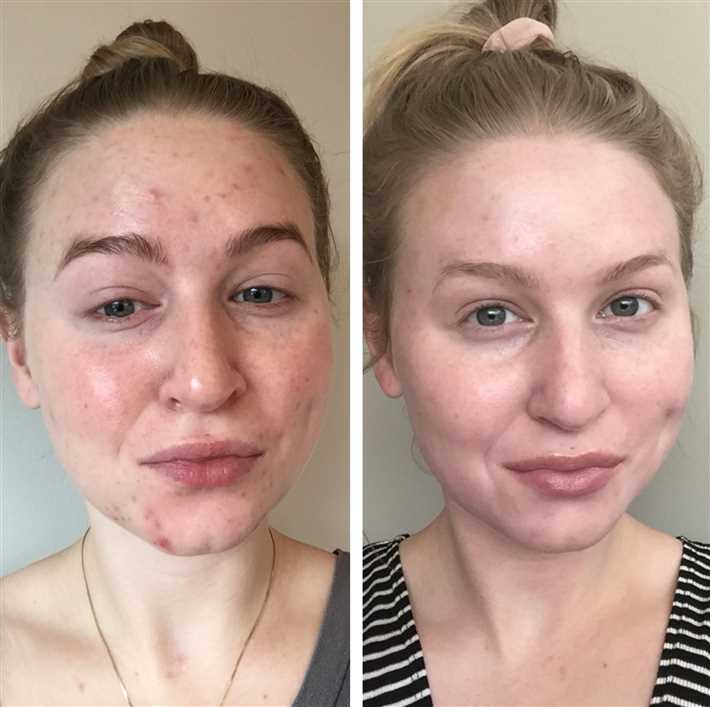 Защищайте кожу от негативных факторов