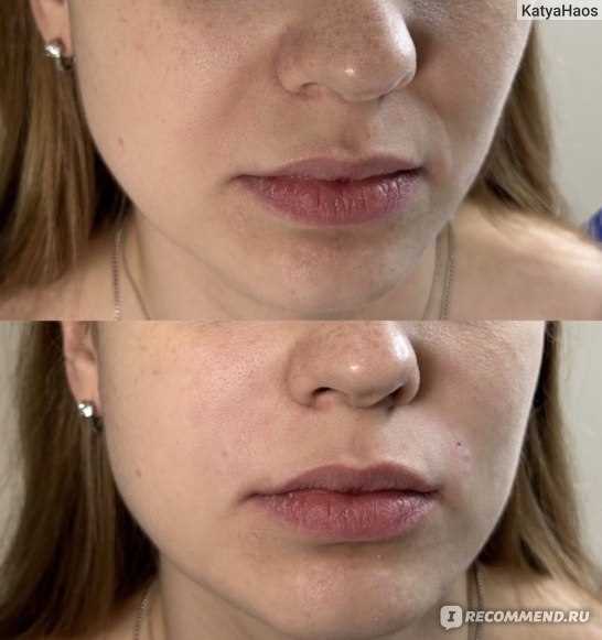 1. Обратитесь к профессионалу