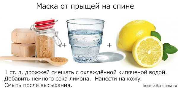 Обратитесь к профессионалу, если прыщи не исчезают