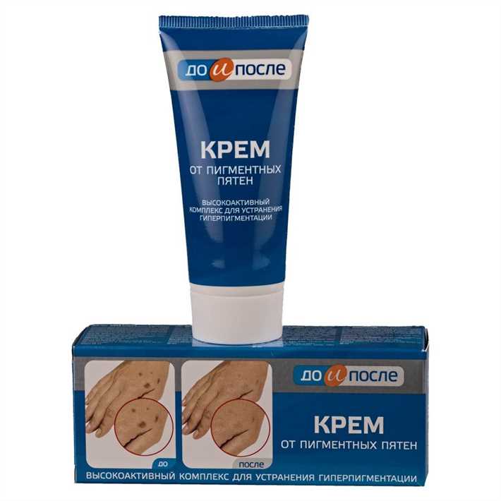 Способы использования кремов от пигментных пятен на лице