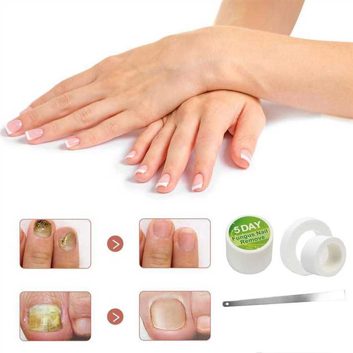 2. Чесночное масло