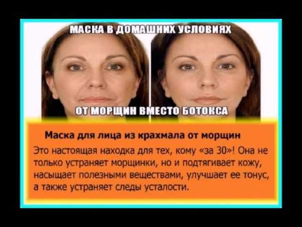 Что такое эффект ботокса для кожи лица?