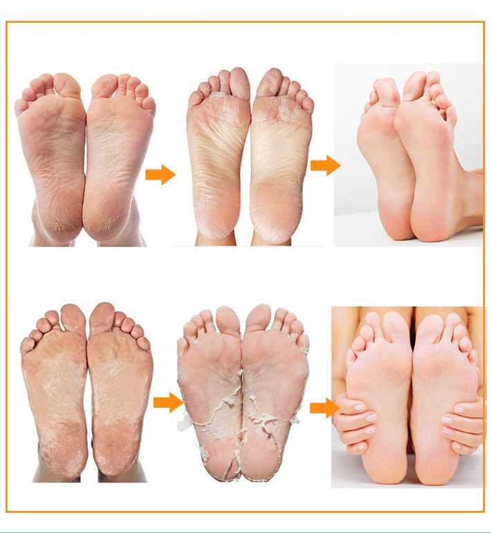 1. Отрезание верхней части маски