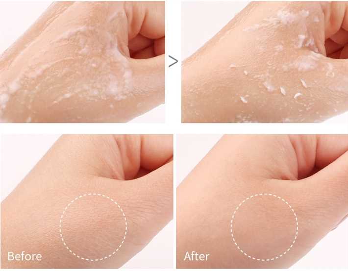 Топ-3 пилинг-скатки для жирной кожи