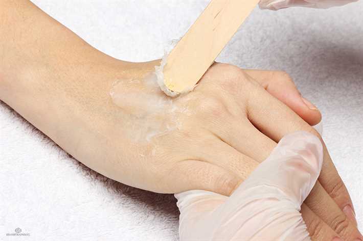 В чем заключается холодная парафинотерапия: основные принципы и преимущества