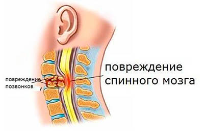 Психологические травмы: симптомы, последствия, лечение - все, что нужно знать Психологические травмы: симптомы, последствия, лечение - все, что нужно знать