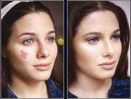 После процедуры