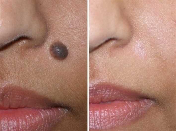 Противопоказания