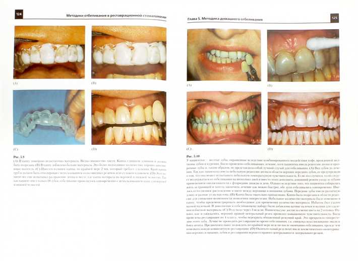 Как использовать активированный уголь для отбеливания зубов?