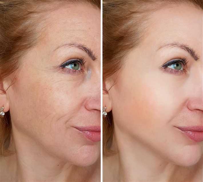 Использование гигиенических средств для ухода