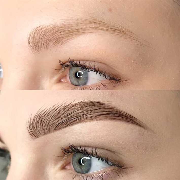 2. Уход после процедуры